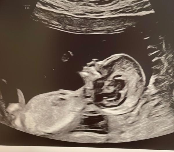 Bild zu Skull Theorie - Forum für September - Mamis