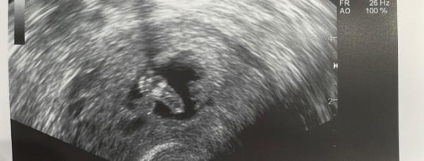 Bild zu Glücklich 😊 - Forum für September - Mamis