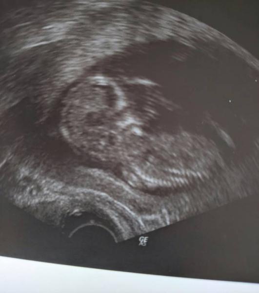 Bild zu Skull Theorie - Forum für September - Mamis