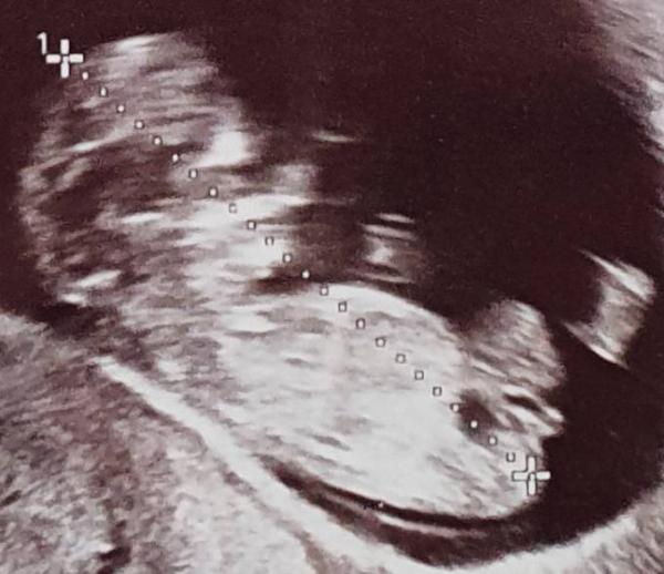 Bild zu Auf der Suche nach "Kenner" bezüglich der NUB-Theorie - Forum für September - Mamis