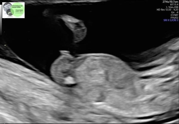 Bild zu Nub Theorie - Forum für September - Mamis