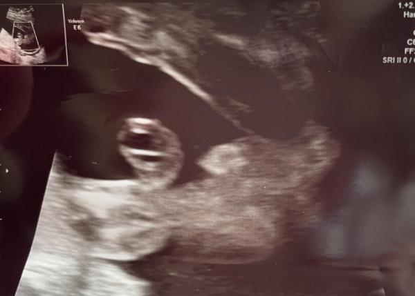 Bild zu Geschlecht ? - Forum für September - Mamis