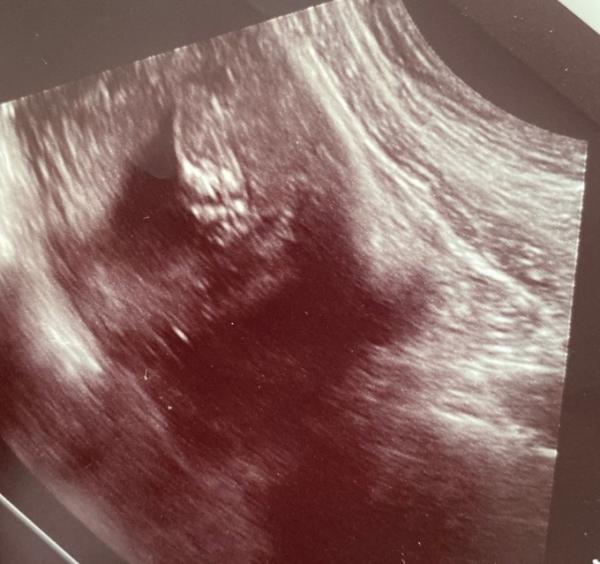 Bild zu Geschlecht Junge oder Mädchen ? - Forum für September - Mamis