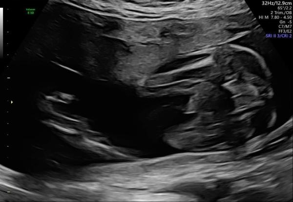 Bild zu Geschlecht - Forum für September - Mamis