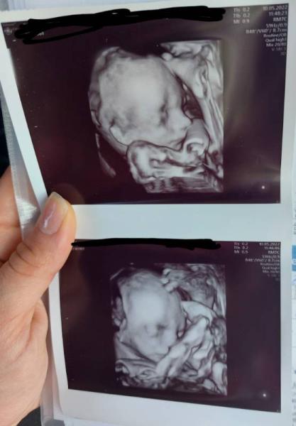 Bild zu Gewicht - Forum für September - Mamis