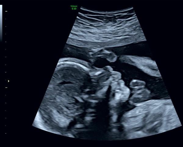 Bild zu It’s a… - Forum für September - Mamis