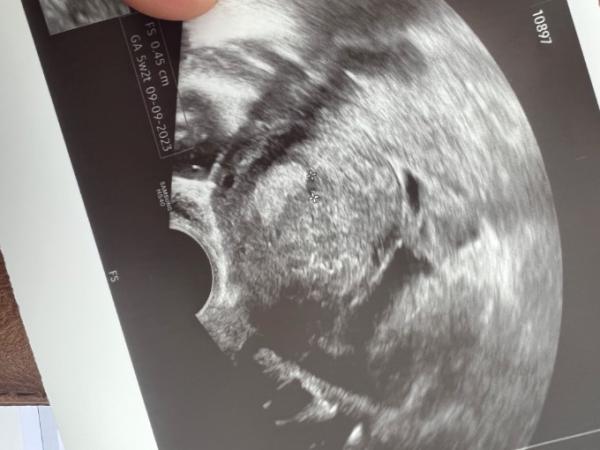 Bild zu Erster Ultraschall bei 4+2 - Forum für September - Mamis