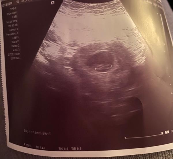 Bild zu Was für ein Tag… / 2. Ultraschall - Forum für September - Mamis