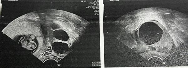 Bild zu Zwischen Glück und Kummer - Forum für September - Mamis