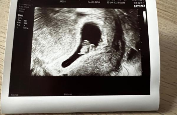 Bild zu FA Termin - Forum für September - Mamis