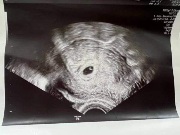 Bild zu Bitte um Erfahrungen - Forum für September - Mamis