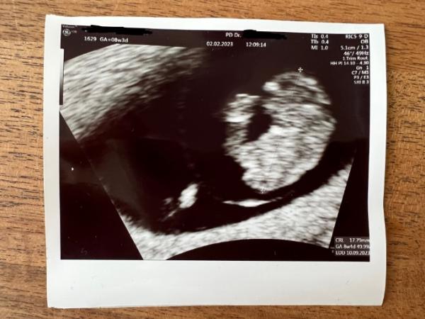 Bild zu 2.US Termin - Forum für September - Mamis
