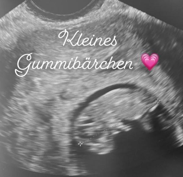 Bild zu Zurück von der FÄ - Forum für September - Mamis