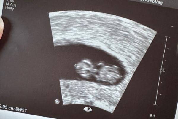 Bild zu Zurück vom Frauenarzt - Forum für September - Mamis