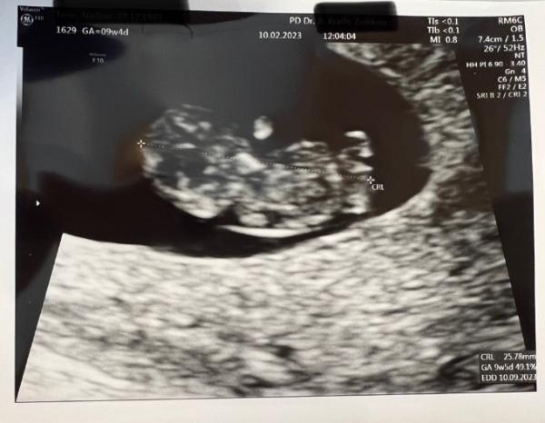 Bild zu kleines update💖 - Forum für September - Mamis