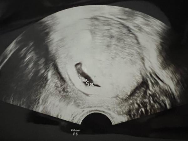 Bild zu Endlos traurig - Forum für September - Mamis