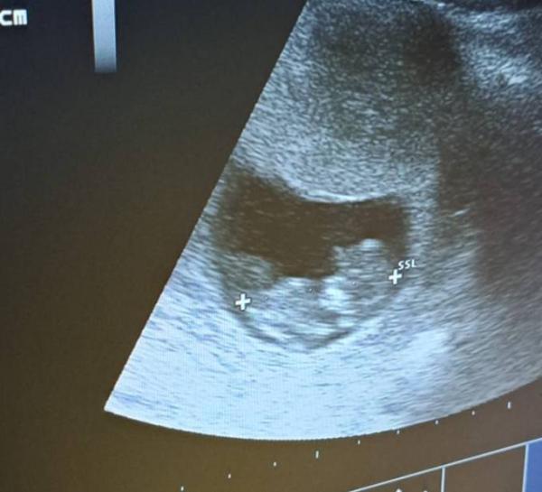 Bild zu Mein kleiner Glückskeks - Forum für September - Mamis