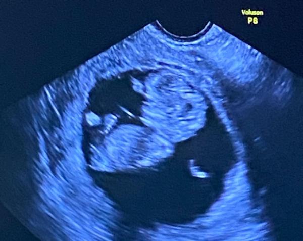 Bild zu Zurück von der FÄ und vordatiert - Forum für September - Mamis