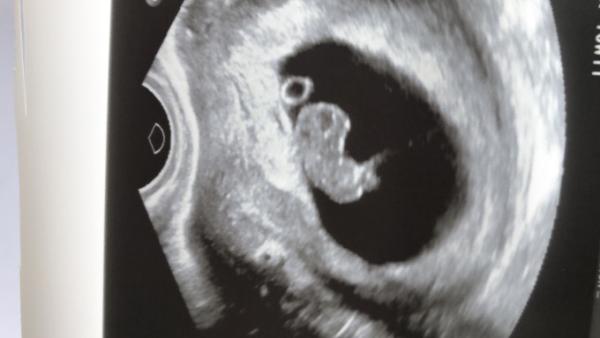 Bild zu Mein 1. Termin und gleich Fragen - Forum für September - Mamis