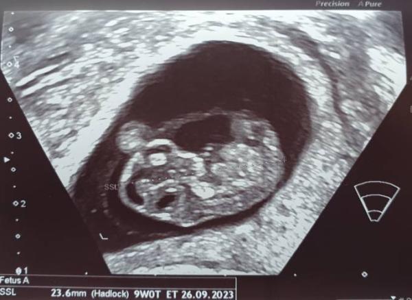 Bild zu 2. Termin :) - Forum für September - Mamis
