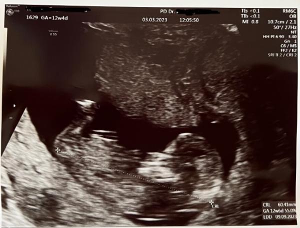 Bild zu Zurück vom FA/ 1. Trimesterscreening - Forum für September - Mamis