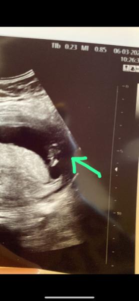 Bild zu Erster Termin bei Hebamme - Forum für September - Mamis