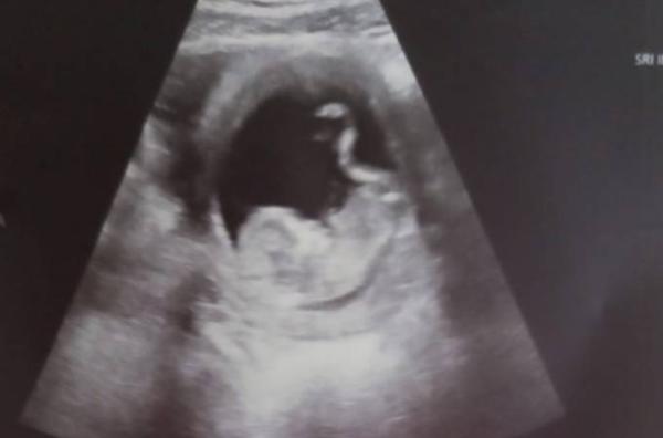 Bild zu Kleines Update Blutungen - Forum für September - Mamis