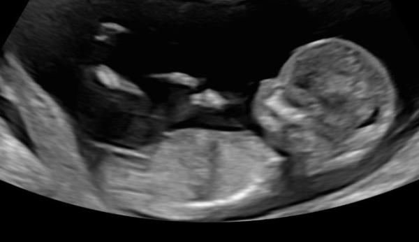 Bild zu So erleichtert und glücklich - Forum für September - Mamis