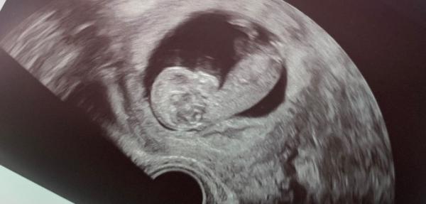 Bild zu NUB THEORIE Experten 😇 unter euch? - Forum für September - Mamis