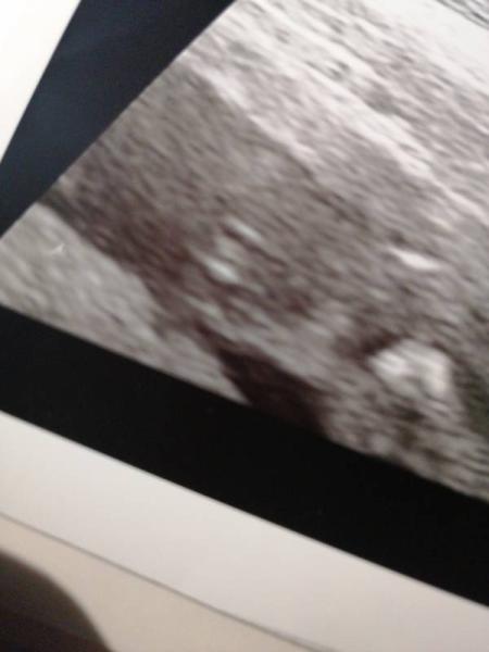 Bild zu Unser Outing 💚💚💚 - Forum für September - Mamis