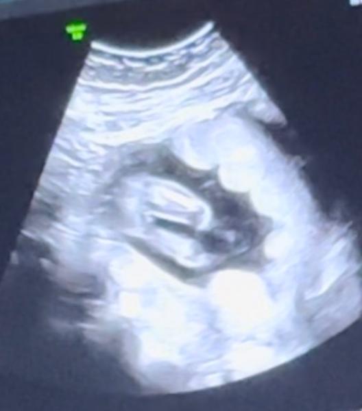 Bild zu Geschlecht? - Forum für September - Mamis