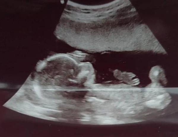 Bild zu Geschlecht? - Forum für September - Mamis
