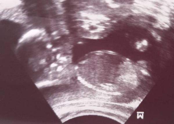 Bild zu Hilfe! Mein Baby ärgert mich ;) - Forum für September - Mamis