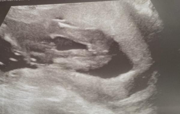 Bild zu Neu hier - Forum für September - Mamis