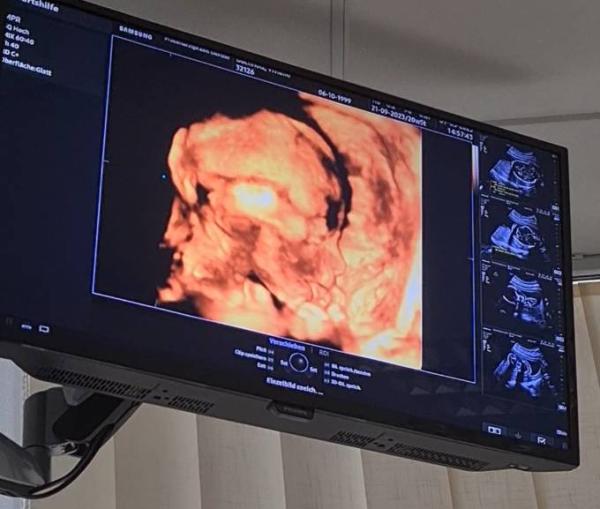 Bild zu Zweite große Ultraschall - Forum für September - Mamis