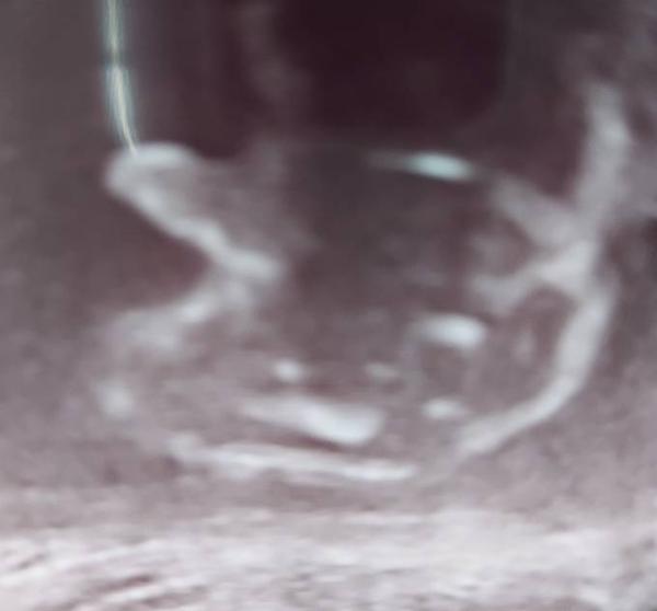 Bild zu Heutiger Termin - Forum für September - Mamis
