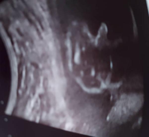 Bild zu Bilder vom Termin - Forum für September - Mamis