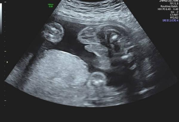 Bild zu Paradebeispiel? - Forum für September - Mamis