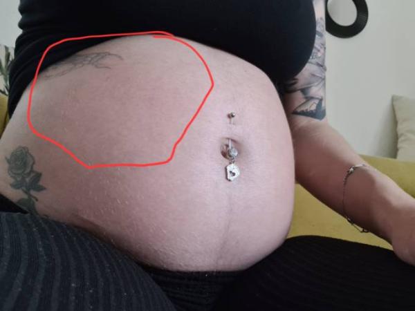 Bild zu Bauch rot und heiß - Forum für September - Mamis