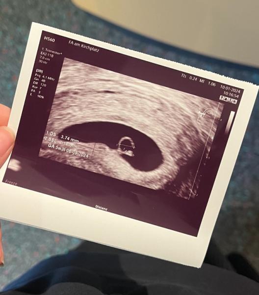 Bild zu Erster Ultraschall 5+3 - Forum für September - Mamis