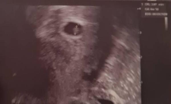 Bild zu .. dann rutschen wir mal in den September. - Forum für September - Mamis
