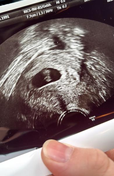 Bild zu Erster FA Termin - Forum für September - Mamis