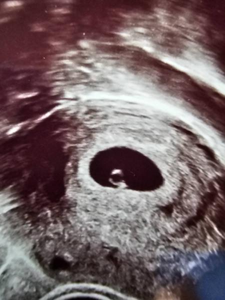 Bild zu Zurück vom Frauenarzt - Forum für September - Mamis