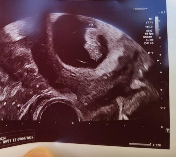 Bild zu Erleichtert :-) - Forum für September - Mamis