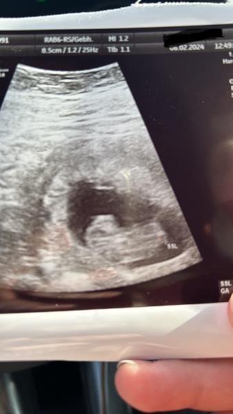 Bild zu 2. FA Termin - Forum für September - Mamis