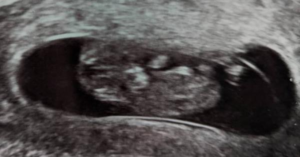 Bild zu Hibbelig vor und beruhigt nach dem Ultraschall. - Forum für September - Mamis