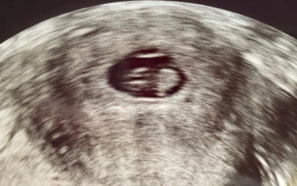 Bild zu Heute zweiter FA Termin - Forum für September - Mamis