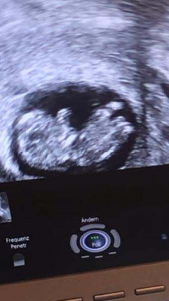 Bild zu Geschlecht erkennen ❤️💙 - Forum für September - Mamis