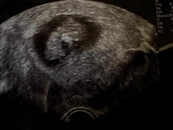 Bild zu Update - Forum für September - Mamis