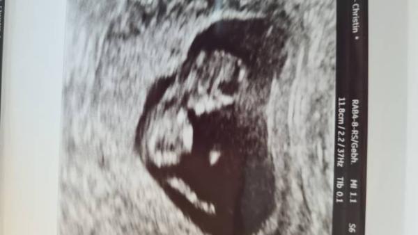Bild zu Heute FA Termin - Forum für September - Mamis